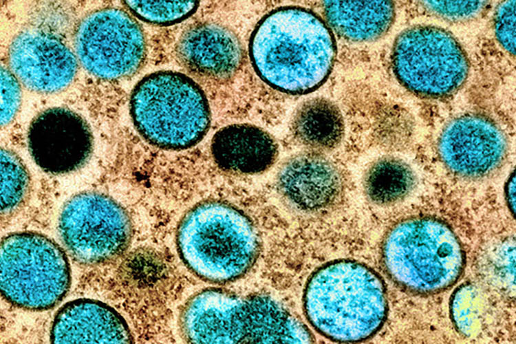 Monkeypox microscope image