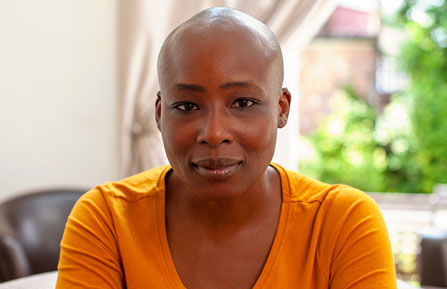 african american woman without hair